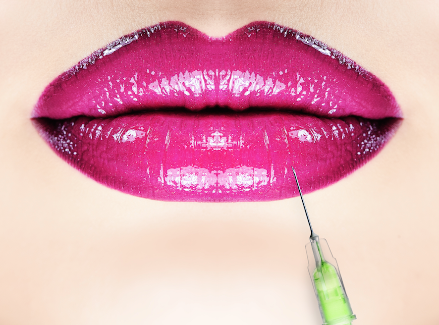 antonia-mariconda-lip-filler-guide